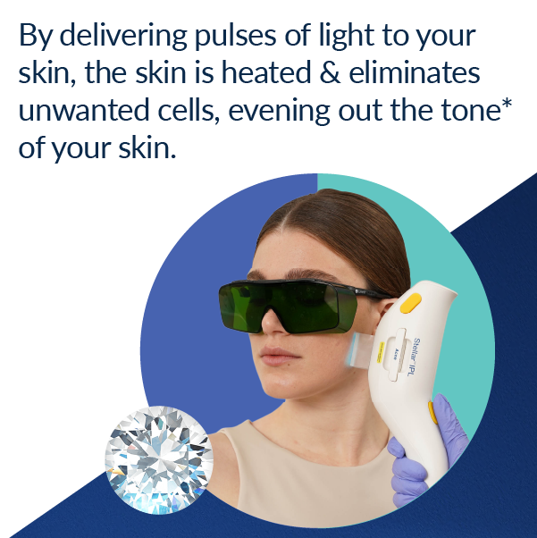 MobileBlogImage-726X600 copy 2 a woman using SmoothGlo