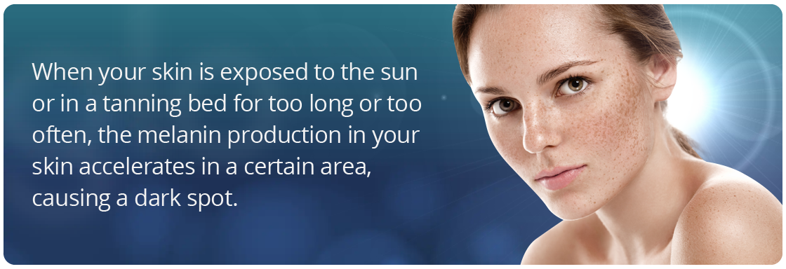 Artboard 1 How sun and a tanning bed can cause dark spots on your skin