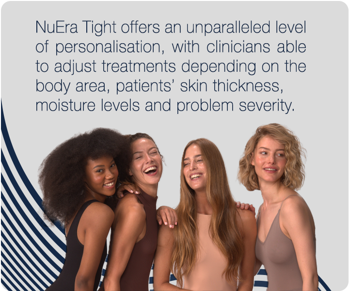 blog-text2-mobile_720X600 4 women laughing and smiling