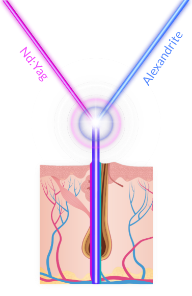 SPX-technology-illustration