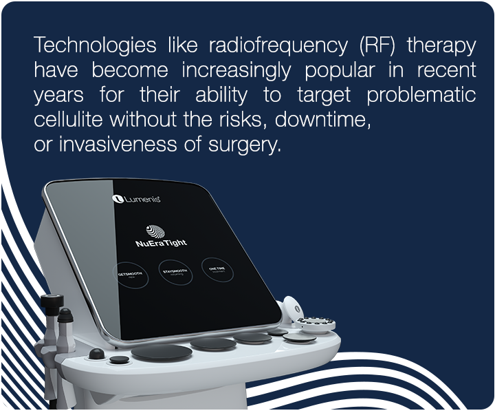 blog-text1-mobile_720X600 NuEra Tight device