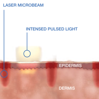 pulsed_cropped pulsed_cropped
