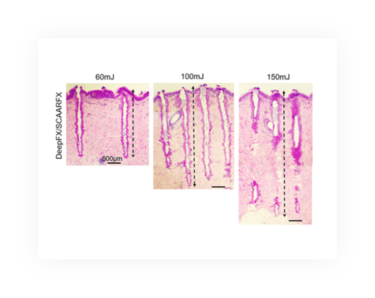 UPA-Histo UltraPulse Alpha penetration depth.