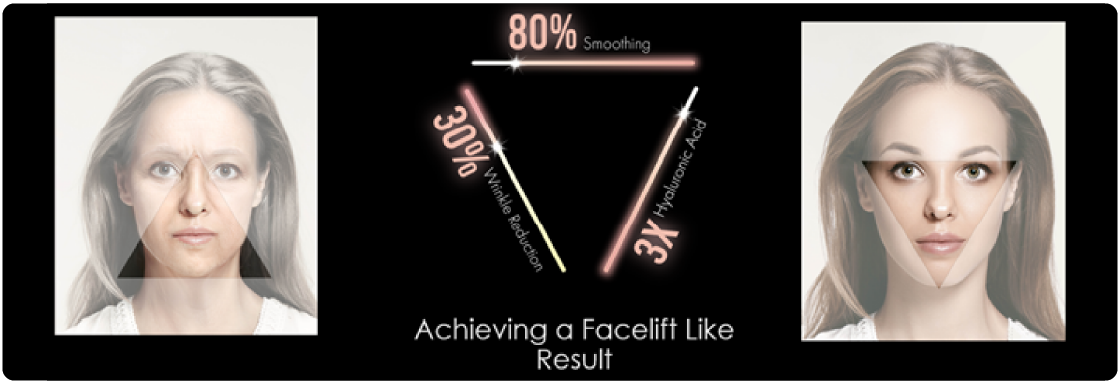 Desktop-image Blog 1120X384 triLift results before and after