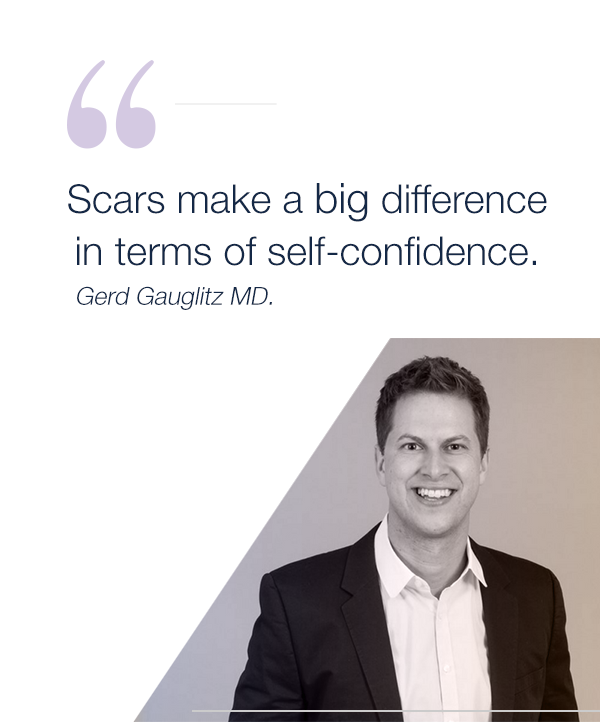 blog-pic_text1-mobile scars make a big difference in terms of self-confidence. a quote from gerd gauglitz