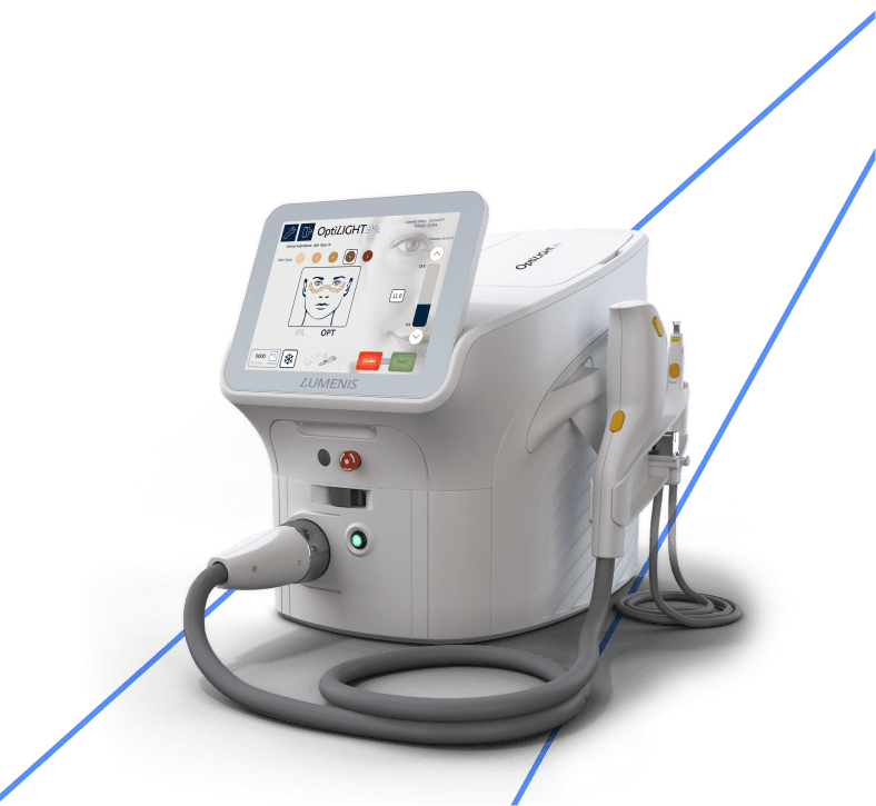 optilight-device-mobile-fixed