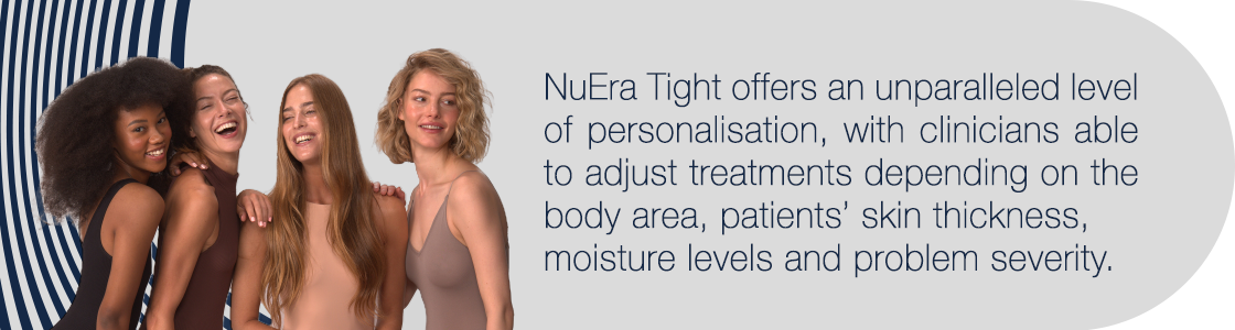 blog-pic_PB-00023440-NuEra-text-2l_1120X300 4 women laughing and smiling