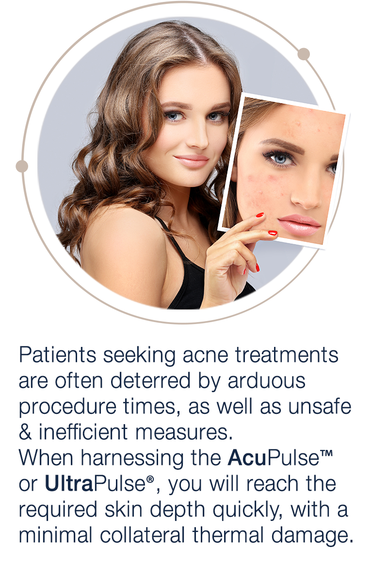 Acne-Scars-The-Lumenis-Solution-pic3-mobile