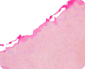 co2-continuous-wave-image1 Superficial mode CW histology