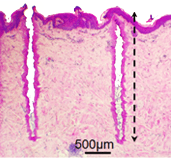 ULTRApulse® Alpha SCAARFX™ Mode